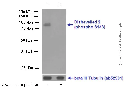 Western blot - Anti-Dishevelled 2 (phospho S143) antibody [EPNCIR145] - BSA and Azide free (AB169950)