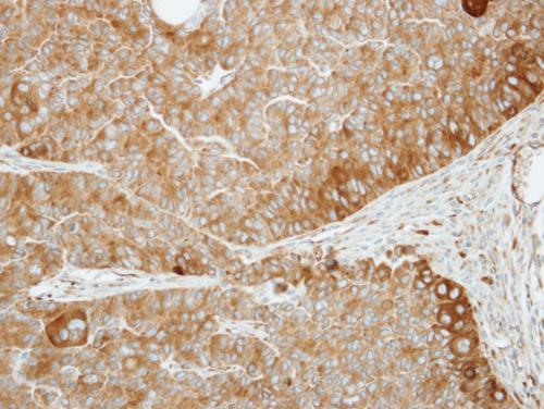 Immunohistochemistry (Formalin/PFA-fixed paraffin-embedded sections) - Anti-Dishevelled 3 antibody - N-terminal (AB152161)