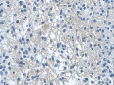 Immunohistochemistry (Formalin/PFA-fixed paraffin-embedded sections) - Anti-Dishevelled / Dvl1 antibody (AB233003)
