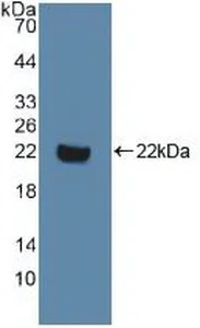 Western blot - Anti-Dishevelled / Dvl1 antibody (AB233003)