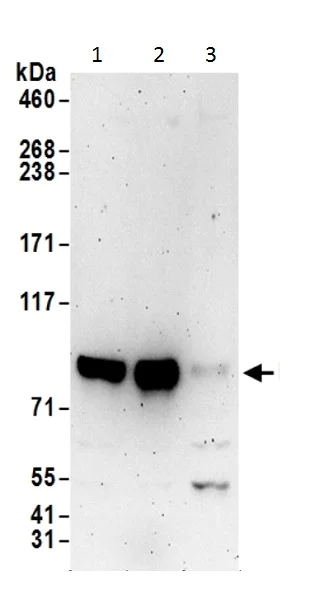 Western blot - Anti-DIXDC1 antibody (AB226210)