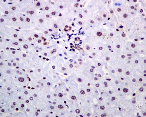 Immunohistochemistry (Formalin/PFA-fixed paraffin-embedded sections) - Anti-DjC8 antibody [EPR9069] (AB138506)