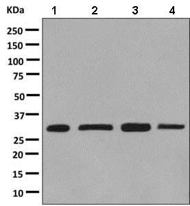 Western blot - Anti-DjC8 antibody [EPR9069] - BSA and Azide free (AB248853)