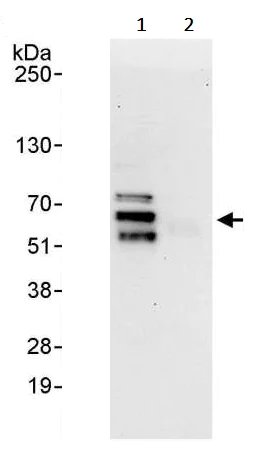 Immunoprecipitation - Anti-DKC1/Dyskerin antibody (AB245559)