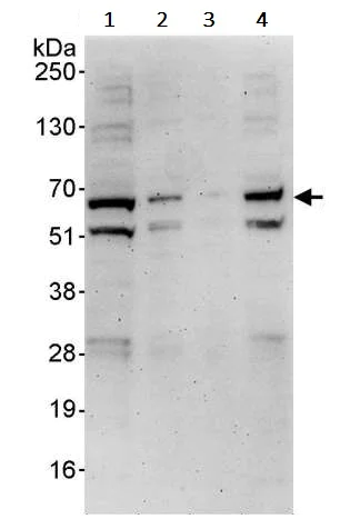 Western blot - Anti-DKC1/Dyskerin antibody (AB245559)