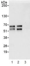 Immunoprecipitation - Anti-DKC1/Dyskerin antibody (AB93777)
