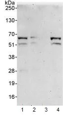 Western blot - Anti-DKC1/Dyskerin antibody (AB93777)