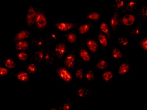 Immunocytochemistry/ Immunofluorescence - Anti-DKC1/Dyskerin antibody [EPR10398] (AB156006)