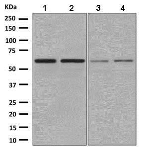 Western blot - Anti-DKC1/Dyskerin antibody [EPR10398] (AB156006)