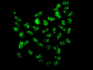 Immunocytochemistry/ Immunofluorescence - Anti-DKC1/Dyskerin antibody [EPR10399] (AB156877), expandable thumbnail