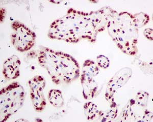 Immunohistochemistry (Formalin/PFA-fixed paraffin-embedded sections) - Anti-DKC1/Dyskerin antibody [EPR10399] (AB156877), expandable thumbnail