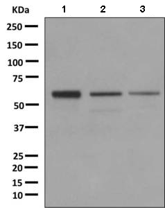 Western blot - Anti-DKC1/Dyskerin antibody [EPR10399] (AB156877), expandable thumbnail
