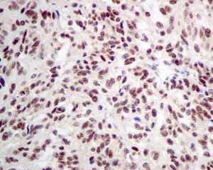 Immunohistochemistry (Formalin/PFA-fixed paraffin-embedded sections) - Anti-DKC1/Dyskerin antibody [EPR10399] - BSA and Azide free (AB249288)