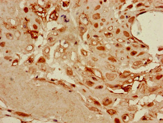 Immunohistochemistry (Formalin/PFA-fixed paraffin-embedded sections) - Anti-DKK1 antibody (AB235990), expandable thumbnail