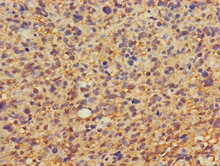 Immunohistochemistry (Formalin/PFA-fixed paraffin-embedded sections) - Anti-DKK1 antibody (AB235990), expandable thumbnail