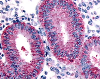 Immunohistochemistry (Formalin/PFA-fixed paraffin-embedded sections) - Anti-DKK1 antibody (AB61034), expandable thumbnail