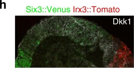 Immunohistochemistry - Anti-DKK1 antibody (AB61034)
