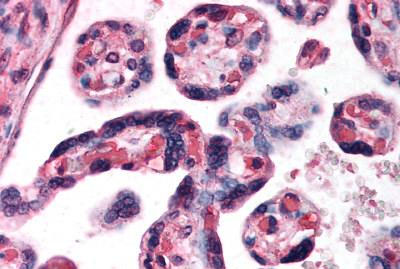 Immunohistochemistry (Formalin/PFA-fixed paraffin-embedded sections) - Anti-DKK1 antibody - C-terminal (AB188597), expandable thumbnail
