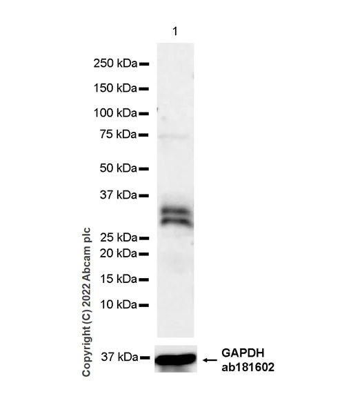 Western blot - Anti-DKK1 antibody [EPR26160-102] - BSA and Azide free (AB307368)