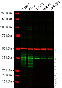 Western blot - Anti-DKK1 antibody [EPR4759] (AB109416)