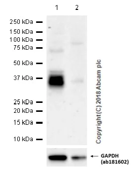 Western blot - Anti-DKK1 antibody [EPR4759] (AB109416)