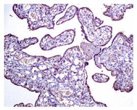 Immunohistochemistry (Formalin/PFA-fixed paraffin-embedded sections) - Anti-DKK1 antibody [EPR4759] - Low endotoxin, Azide free (AB221779), expandable thumbnail