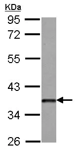 Western blot - Anti-Dkk3 antibody (AB126080)