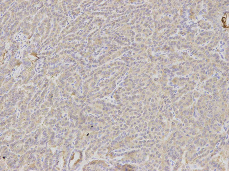 Immunohistochemistry (Formalin/PFA-fixed paraffin-embedded sections) - Anti-Dkk3 antibody (AB187532)