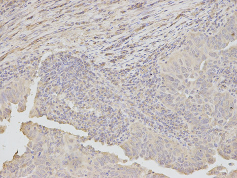 Immunohistochemistry (Formalin/PFA-fixed paraffin-embedded sections) - Anti-Dkk3 antibody (AB187532)