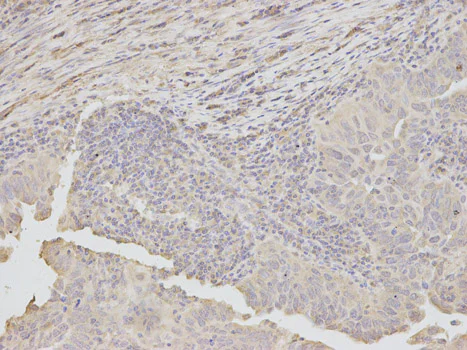Immunohistochemistry (Formalin/PFA-fixed paraffin-embedded sections) - Anti-Dkk3 antibody (AB187532)