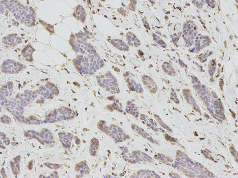 Immunohistochemistry (Formalin/PFA-fixed paraffin-embedded sections) - Anti-Dkk3 antibody (AB187532)