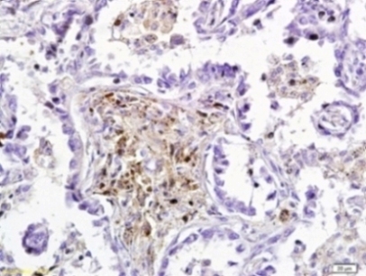 Immunohistochemistry (Formalin/PFA-fixed paraffin-embedded sections) - Anti-Dkk3 antibody (AB214360)