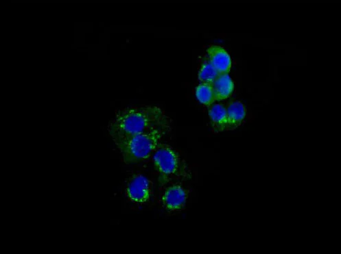 Immunocytochemistry/ Immunofluorescence - Anti-Dkk3 antibody [EPR15611] (AB186409)