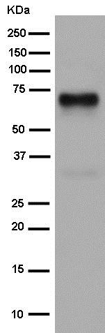 Western blot - Anti-Dkk3 antibody [EPR15611] (AB186409)