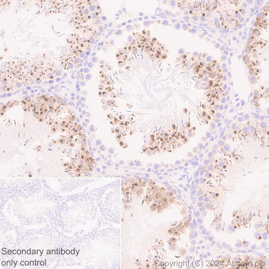 Immunohistochemistry (Formalin/PFA-fixed paraffin-embedded sections) - Anti-DKKL1 antibody [EPR25721-68] (ab316308), expandable thumbnail