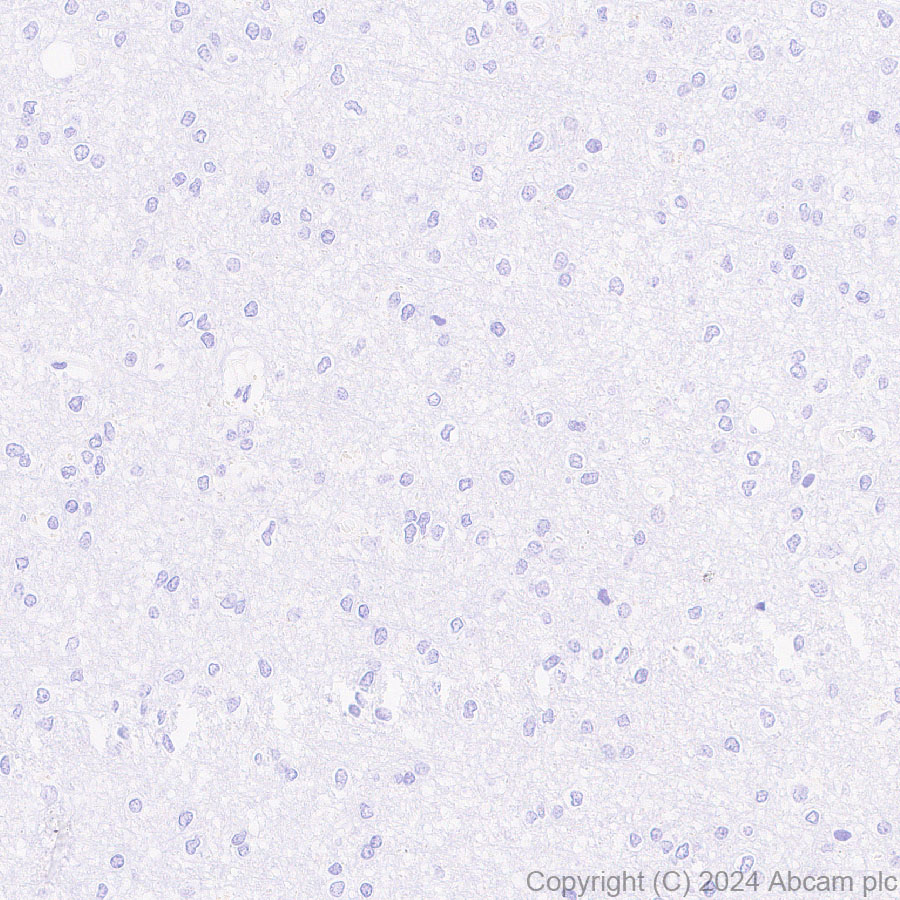Immunohistochemistry (Formalin/PFA-fixed paraffin-embedded sections) - Anti-DKKL1 antibody [EPR25721-68] (ab316308), expandable thumbnail