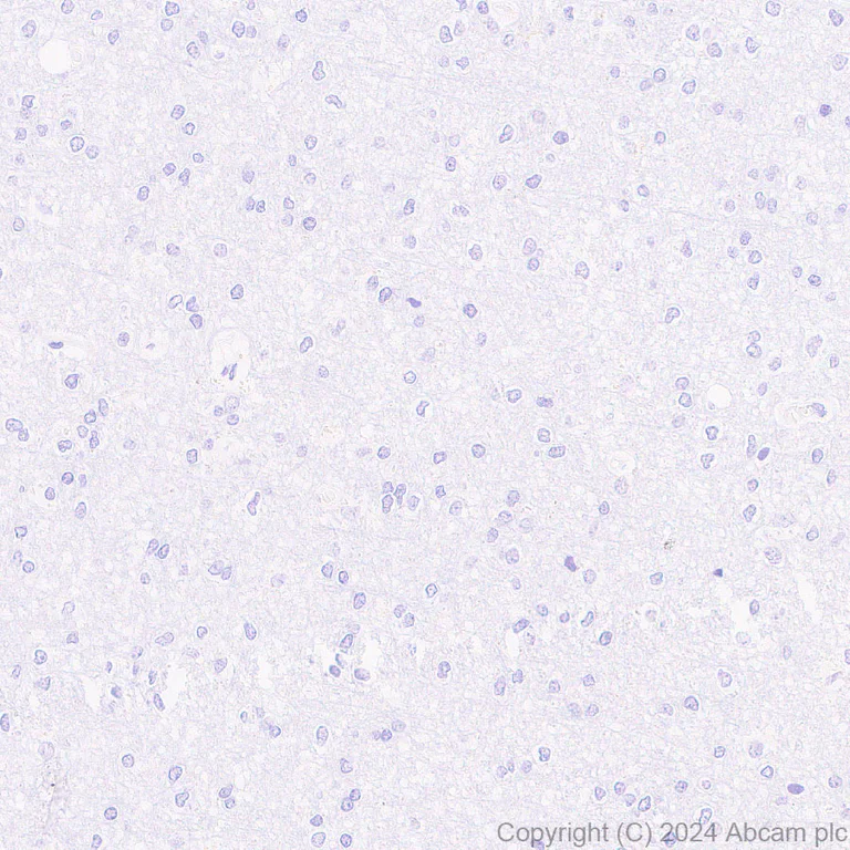 Immunohistochemistry (Formalin/PFA-fixed paraffin-embedded sections) - Anti-DKKL1 antibody [EPR25721-68] (AB316308)