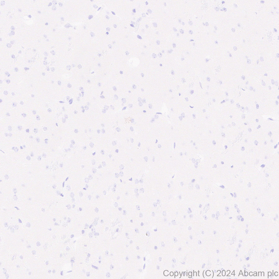 Immunohistochemistry (Formalin/PFA-fixed paraffin-embedded sections) - Anti-DKKL1 antibody [EPR25721-68] (AB316308), expandable thumbnail