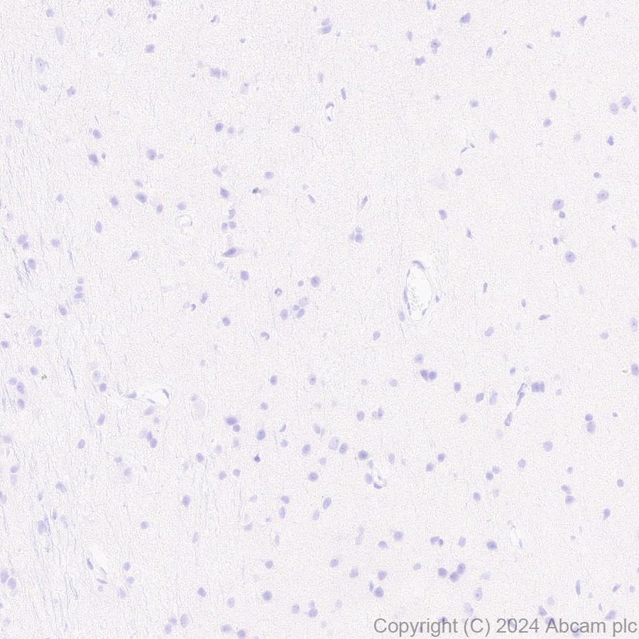 Immunohistochemistry (Formalin/PFA-fixed paraffin-embedded sections) - Anti-DKKL1 antibody [EPR25721-68] (AB316308), expandable thumbnail
