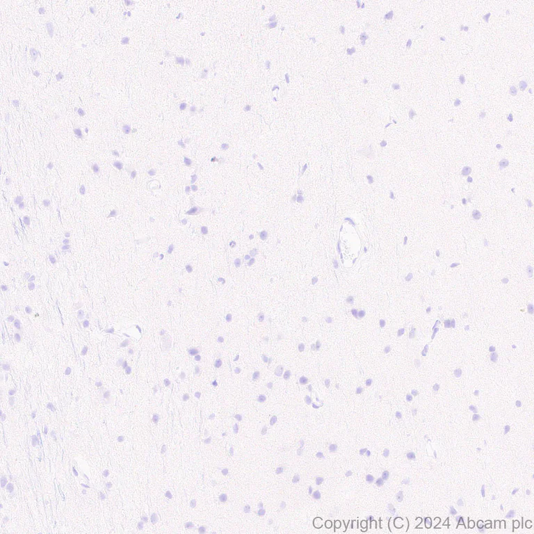 Immunohistochemistry (Formalin/PFA-fixed paraffin-embedded sections) - Anti-DKKL1 antibody [EPR25721-68] (AB316308)