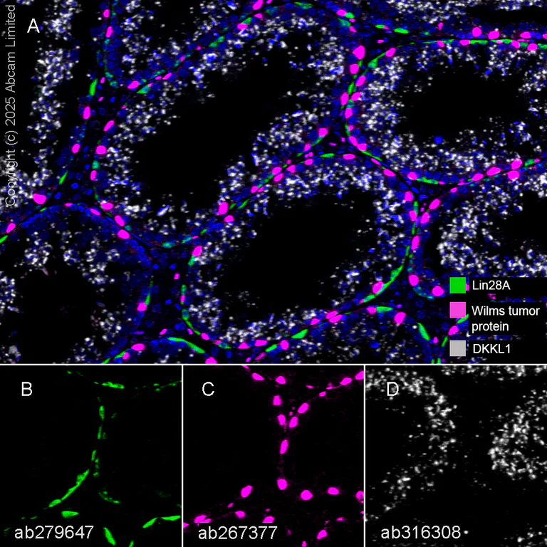 Multiplex immunohistochemistry - Anti-DKKL1 antibody [EPR25721-68] (AB316308)