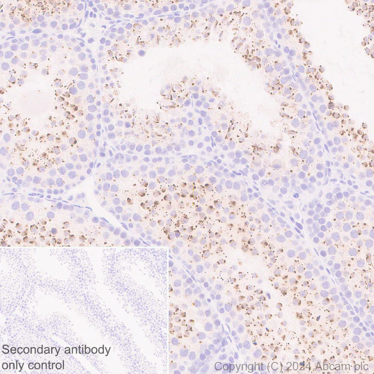 Immunohistochemistry (Formalin/PFA-fixed paraffin-embedded sections) - Anti-DKKL1 antibody [EPR25721-68] - BSA and Azide free (AB316309)