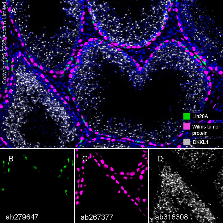 Multiplex immunohistochemistry - Anti-DKKL1 antibody [EPR25721-68] - BSA and Azide free (AB316309)