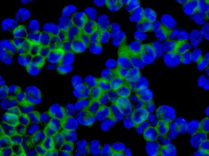 Immunocytochemistry/ Immunofluorescence - Anti-DLC-A antibody [EPR11240] - BSA and Azide free (AB249334)