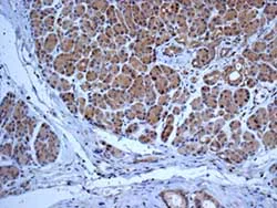 Immunohistochemistry (Formalin/PFA-fixed paraffin-embedded sections) - Anti-DLC-A antibody [EPR11240] - BSA and Azide free (AB249334)