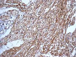 Immunohistochemistry (Formalin/PFA-fixed paraffin-embedded sections) - Anti-DLC-A antibody [EPR11240] - BSA and Azide free (AB249334)