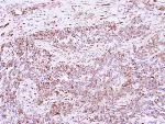 Immunohistochemistry (Formalin/PFA-fixed paraffin-embedded sections) - Anti-DLC1 antibody (AB126257)