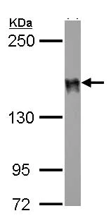 Western blot - Anti-DLC1 antibody (AB126257)