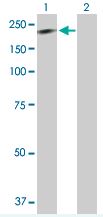 Western blot - Anti-DLC1 antibody (AB168790)