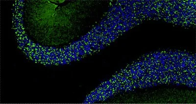 Immunohistochemistry (Formalin/PFA-fixed paraffin-embedded sections) - Anti-DLG4 antibody [K28/43] - Chicken IgY (Chimeric) (AB325661)